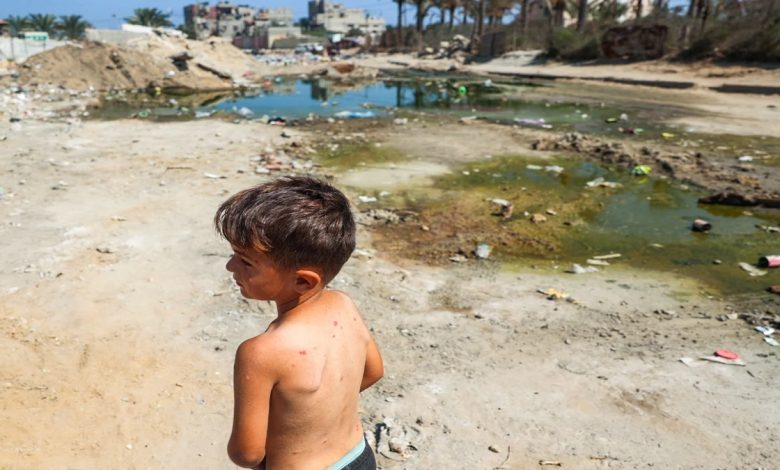 Experts Fear Polio is Spreading Undetected in Gaza
